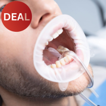 OPTRAGATE DRY CONTROL 30PCS