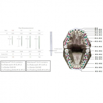 RTD MATCHPOST KIT B (10 POSTS / 3 DRILLS)
